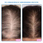 Nordicgrow – Hiustenlähtöä vastaan ​​ja paksummille hiuksille