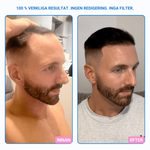 Nordicgrow – Hiustenlähtöä vastaan ​​ja paksummille hiuksille