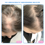 Nordicgrow – Hiustenlähtöä vastaan ​​ja paksummille hiuksille