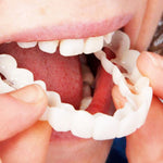 Tandblekning SnapOn™ – Snabbtandsblekning med Tandöverdrag