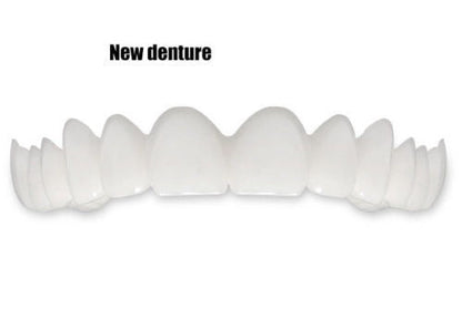 Tandblekning SnapOn™ – Snabbtandsblekning med Tandöverdrag