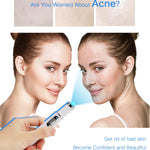 VeinErase™ – Effektiv fjerning av åreknuter og spindelvener 