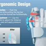 Toe Straight™ – Vaivaisenluun tuki varpaiden erottimella – Säädettävä 