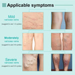 VeinErase™ – Effektiv fjerning av åreknuter og spindelvener 