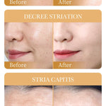 CollagenMask™ – 10-pakning antialdringsmasker med fuktighet og glød