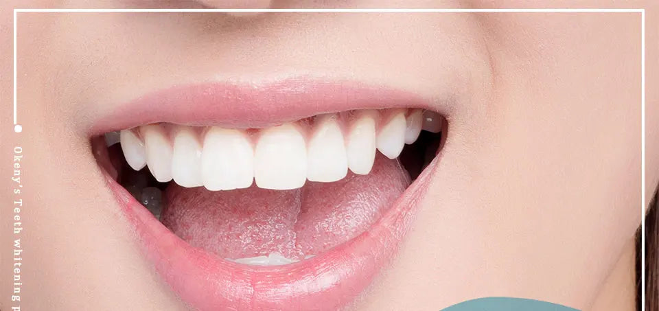 SmileBright™ – Tandblekningspenna 5 ml