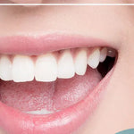 SmileBright™ – Tandblekningspenna 5 ml