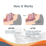 Anti-snarkbett – tand- & snarkskena mot snarkningar