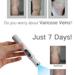 VeinErase™ – Effektiv fjerning av åreknuter og spindelvener 