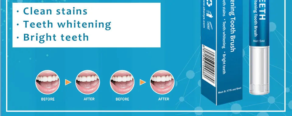 SmileBright™ – Tandblekningspenna 5 ml