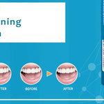 SmileBright™ – Tandblekningspenna 5 ml