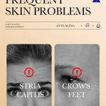 CollagenMask™ – 10-pakning antialdringsmasker med fuktighet og glød