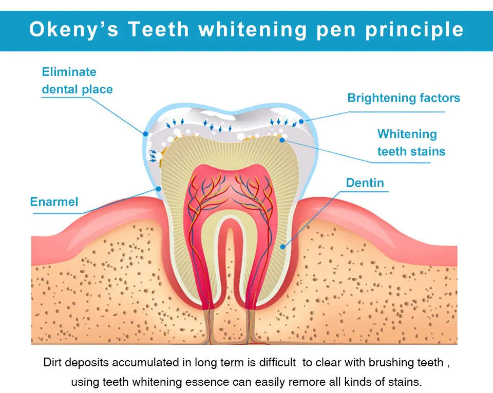 SmileBright™ – Tandblekningspenna 5 ml