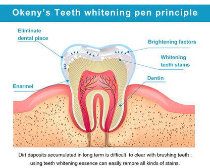 SmileBright™ – Tandblekningspenna 5 ml