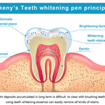 SmileBright™ – Tandblekningspenna 5 ml