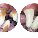 TandFix  – effektiv tandrengöring direkt hemma för både  hund och katt
